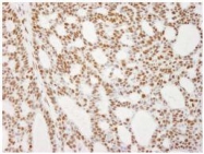 NB100-619 - RecQ1 / RECQL