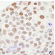 NB100-619 - RecQ1 / RECQL