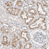 NBP1-83437 - RecQ5 / RECQL5