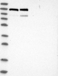 NBP1-83438 - RecQ5 / RECQL5