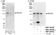 NBP1-40340 - RecQ5 / RECQL5