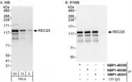 NBP1-40341 - RecQ5 / RECQL5