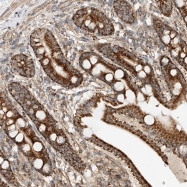 NBP1-90238 - ADARB2 / ADAR3