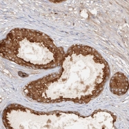 NBP1-90239 - ADARB2 / ADAR3