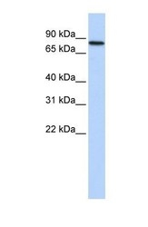 NBP1-57558 - ADARB2 / ADAR3