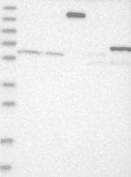 NBP1-90239 - ADARB2 / ADAR3