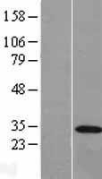 NBL1-15268 - REEP3 Lysate