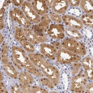 NBP1-80851 - RENBP / AGE