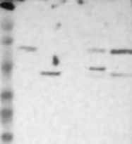 NBP1-80851 - RENBP / AGE