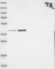 NBP1-89341 - RFC2 / RFC40