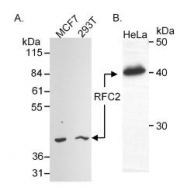 NB100-231 - RFC2 / RFC40