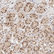 NBP1-82668 - RFC3 / RFC38