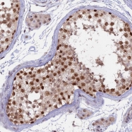 NBP1-87137 - RFC5 / RFC36