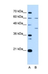 NBP1-58108 - RFC5 / RFC36