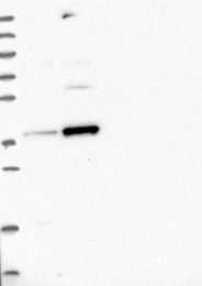 NBP1-87137 - RFC5 / RFC36