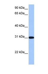 NBP1-56360 - RFPL2 / RNF79