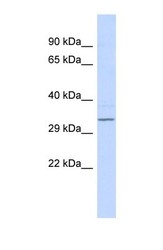 NBP1-55032 - RFPL4B / RNF211