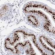 NBP1-86301 - RFX3