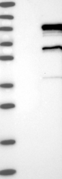 NBP1-86301 - RFX3