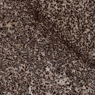NBP1-86041 - RFX5