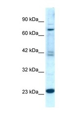 NBP1-55396 - RGS10
