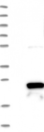 NBP1-86020 - RGS10