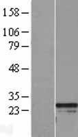 NBL1-15327 - RGS2 Lysate