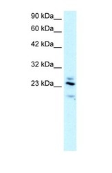 NBP1-54885 - RGS20