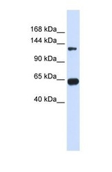NBP1-56546 - RGS22