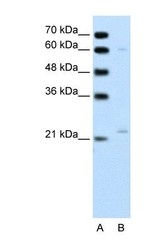 NBP1-58901 - RGS4