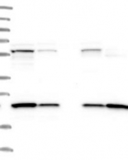 NBP1-87072 - RGS4