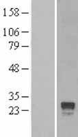 NBL1-15334 - RGS4 Lysate