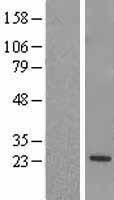 NBL1-15335 - RGS5 Lysate