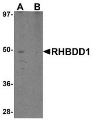 NBP1-76248 - RHBDD1