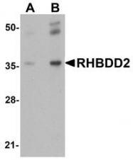 NBP1-76249 - RHBDD2
