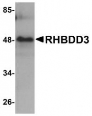 NBP1-76250 - RHBDD3