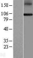 NBL1-15343 - RHBDF1 Lysate