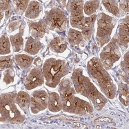 NBP1-92332 - RHBDL2