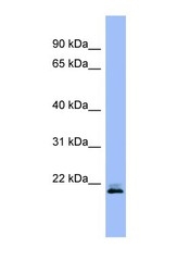 NBP1-58861 - RHEB