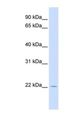 NBP1-58891 - RHEBL1