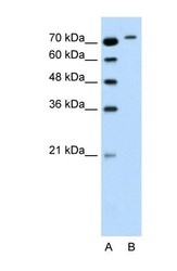 NBP1-58908 - RHOBTB1