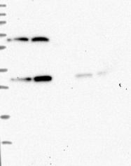 NBP1-81485 - RHOBTB1