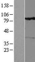 NBL1-15352 - RHOBTB1 Lysate