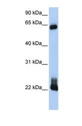 NBP1-58359 - RhoD