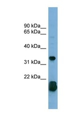 NBP1-55116 - RhoF