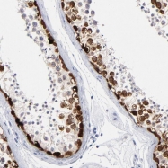 NBP1-84364 - RHOXF2