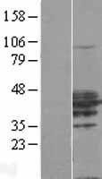 NBL1-15362 - RHOXF2 Lysate