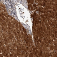 NBP1-82880 - Rhophilin 1 / RHPN1