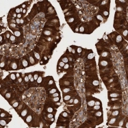 NBP1-82881 - Rhophilin 1 / RHPN1