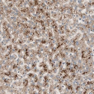 NBP1-86931 - Rhophilin 1 / RHPN1